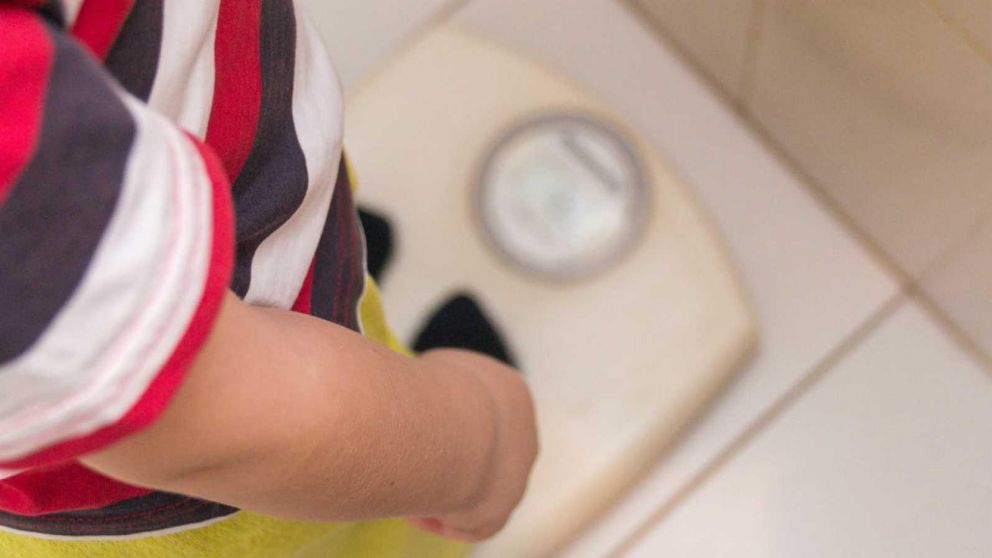 La obesidad infantil sigue siendo un problema de salud pública en España, especialmente en entornos vulnerables.