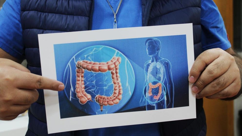 Los cambios en la rutina durante el verano pueden alterar la microbiota intestinal, afectando la salud digestiva e inmune.