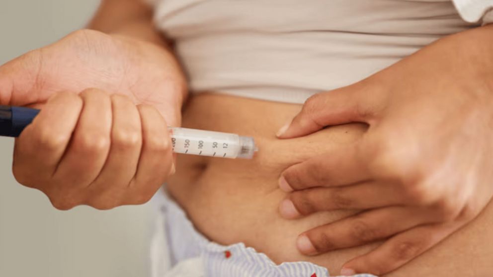 Wegovy llega a Argentina: cómo actúa el nuevo medicamento para perder peso y cuándo estará disponible