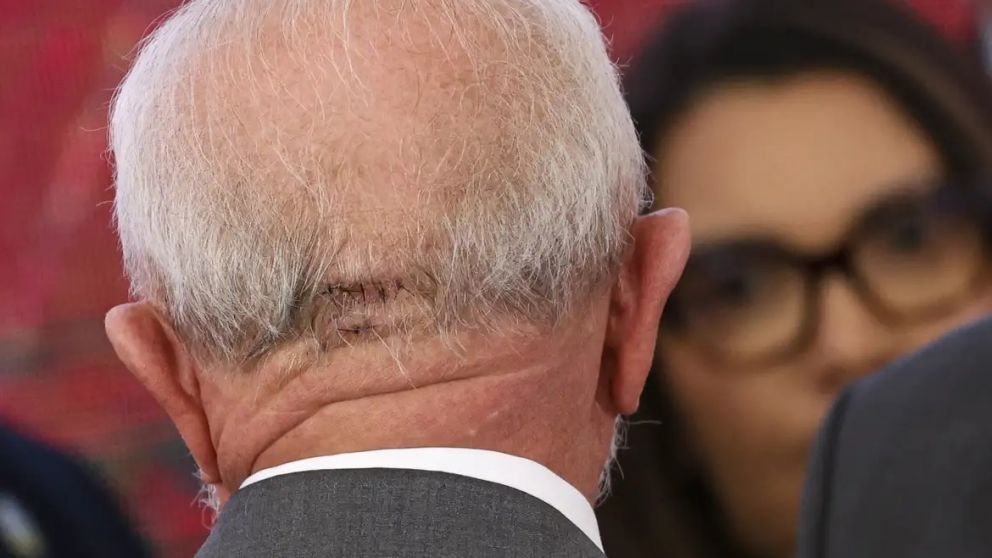 Al presidente se le prohibió viajar en avión tras recibir cinco puntos de sutura en la nuca