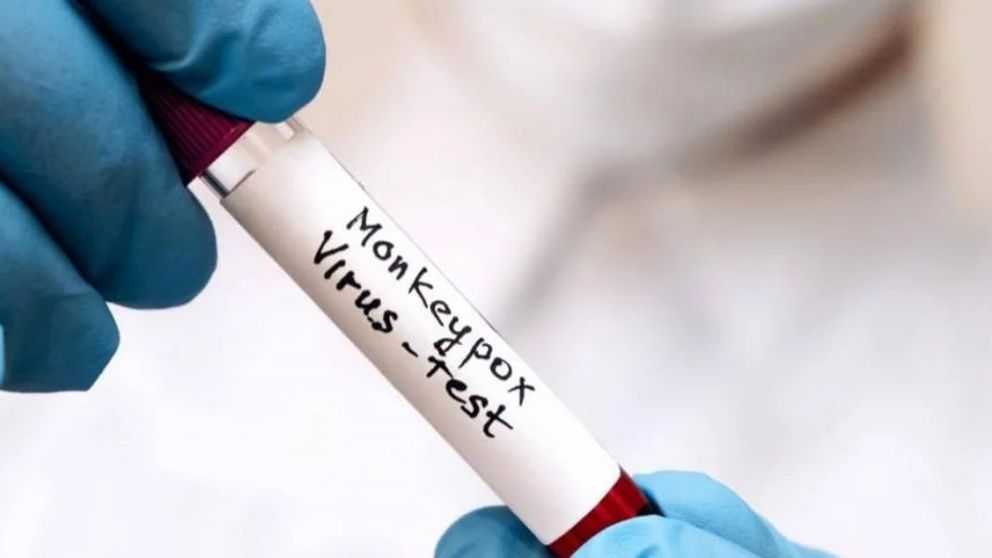 La OMS lanza un plan estratégico mundial para contener el brote de mpox