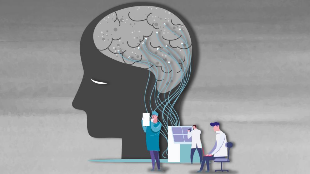 La hipoacusia es una factor de riesgo para el Alzheimer