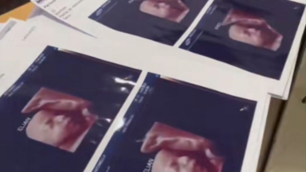 Ese beneficio era de $3.303