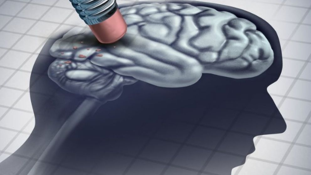 Enfermedad de Alzheimer, una pandemia silenciosa