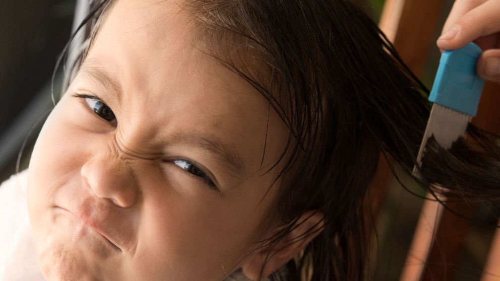 La inversión necesaria para poder sacarle los piojos a los chicos