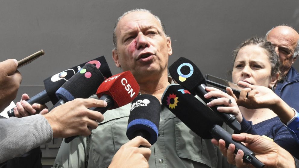 Berni aceptó las disculpas de los colectiveros que lo golpearon