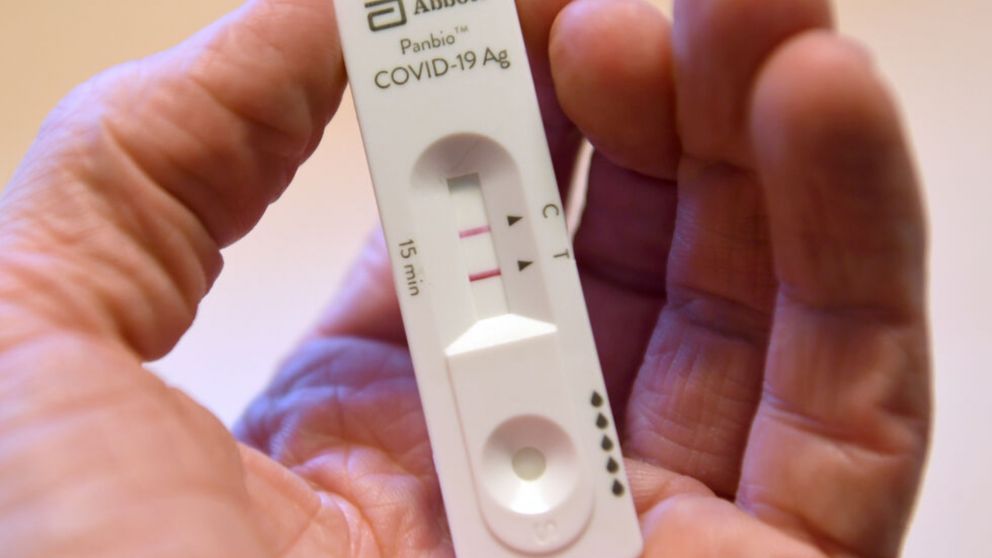 Cuánto cuestan los autotest para Covid en Argentina