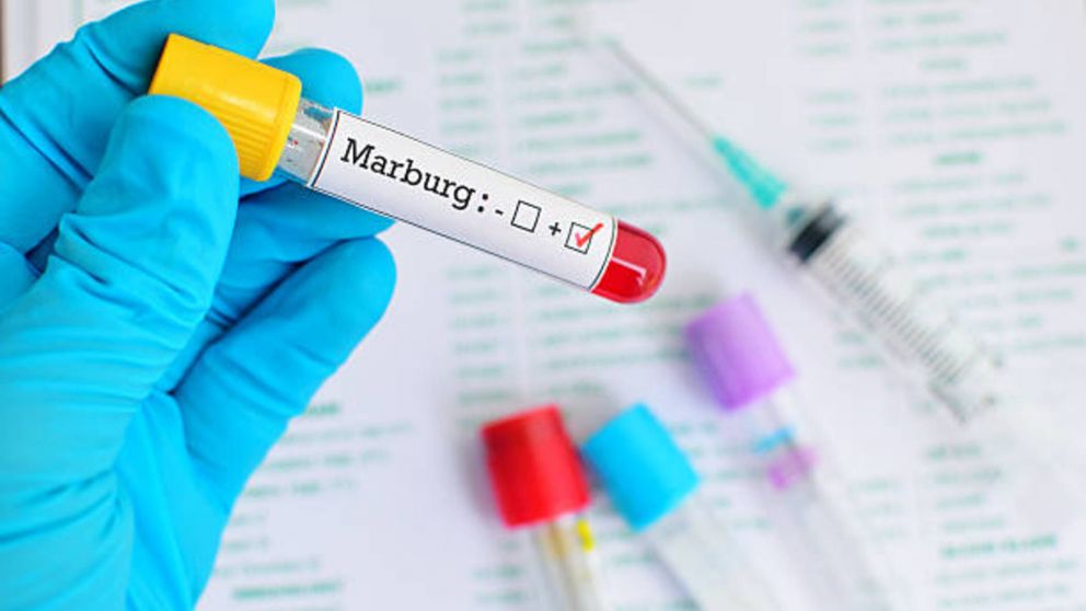 El virus de Marburgo deja "aspecto de fantasma" en pacientes, ¿qué es?