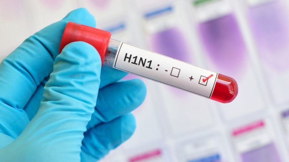 Brote de gripe A en menores de edad