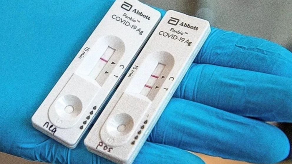 Los autotest tienen un valor de 1.650 pesos en todo el país