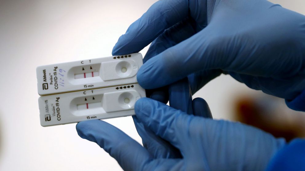 El kit viene con un test de antígenos para certificar el positivo