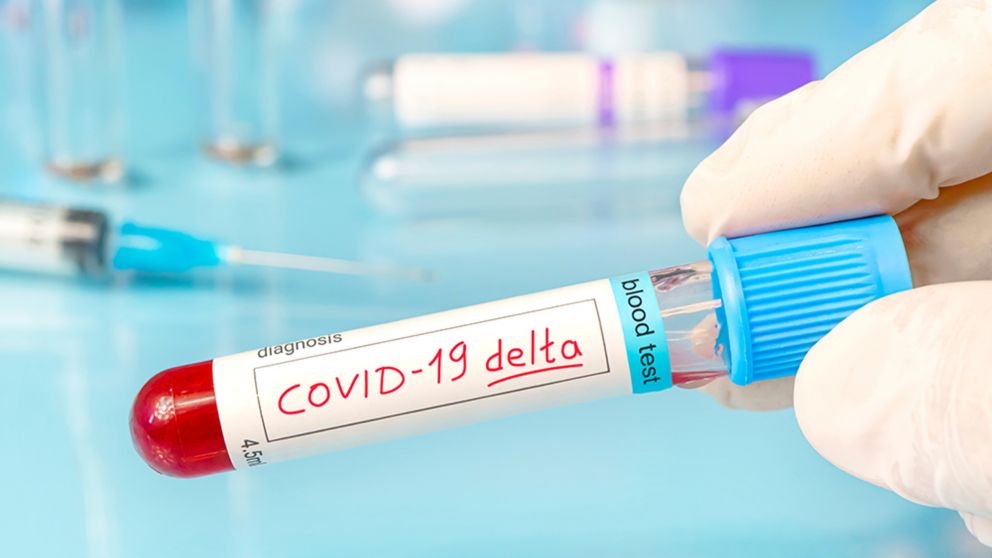 Coronavirus: variante delta en Tucumán