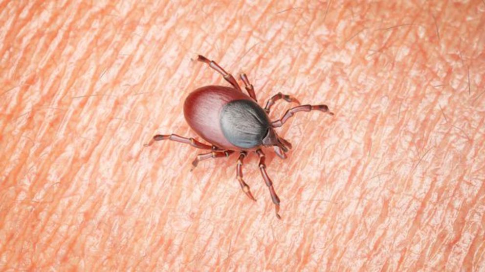 Enfermedad de Lyme en Argentina