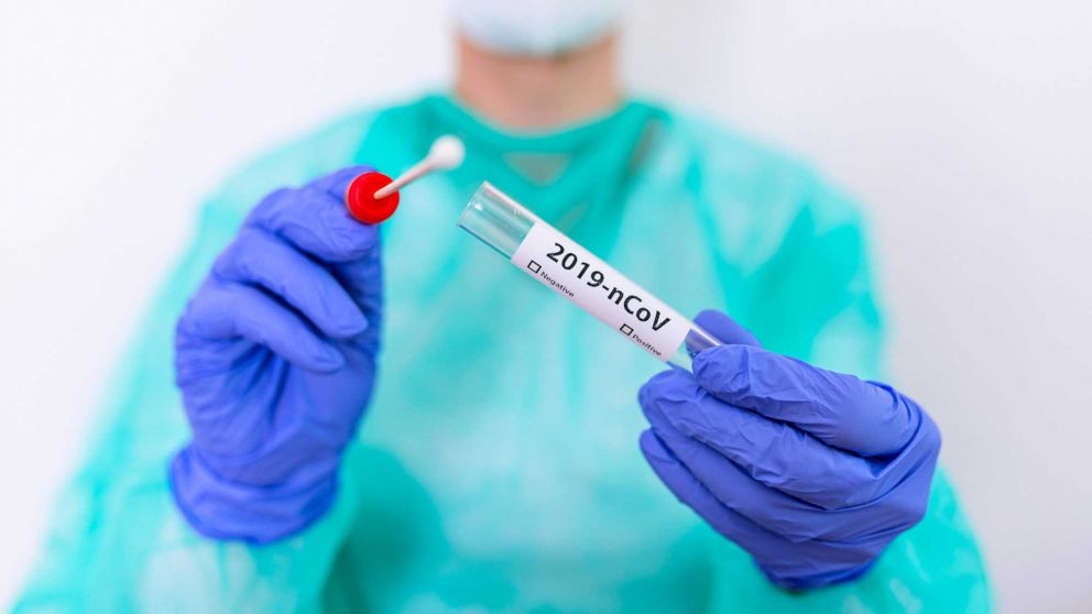 Hisopados covid: ya no habr� que esperar para testearse
