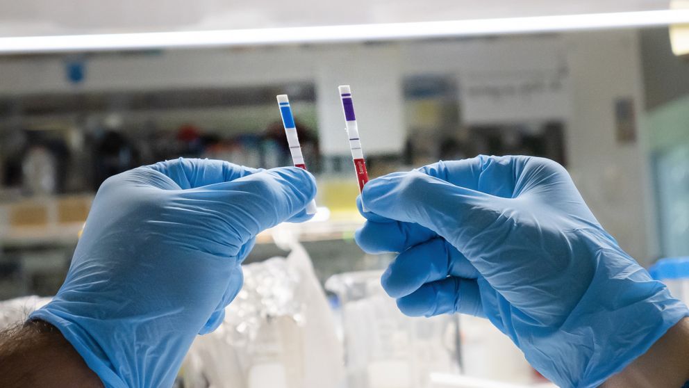 Investigadores argentinos desarrollan un kit de test rápido para detectar coronavirus