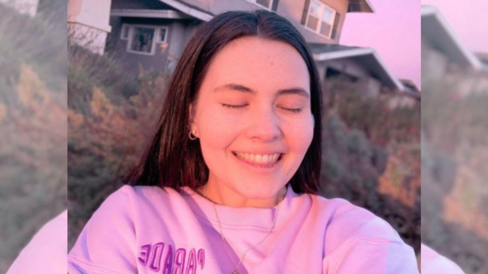 Tessa de 21 años sufre "urticaria acuagénica", llamada comúnmente alergia al agua