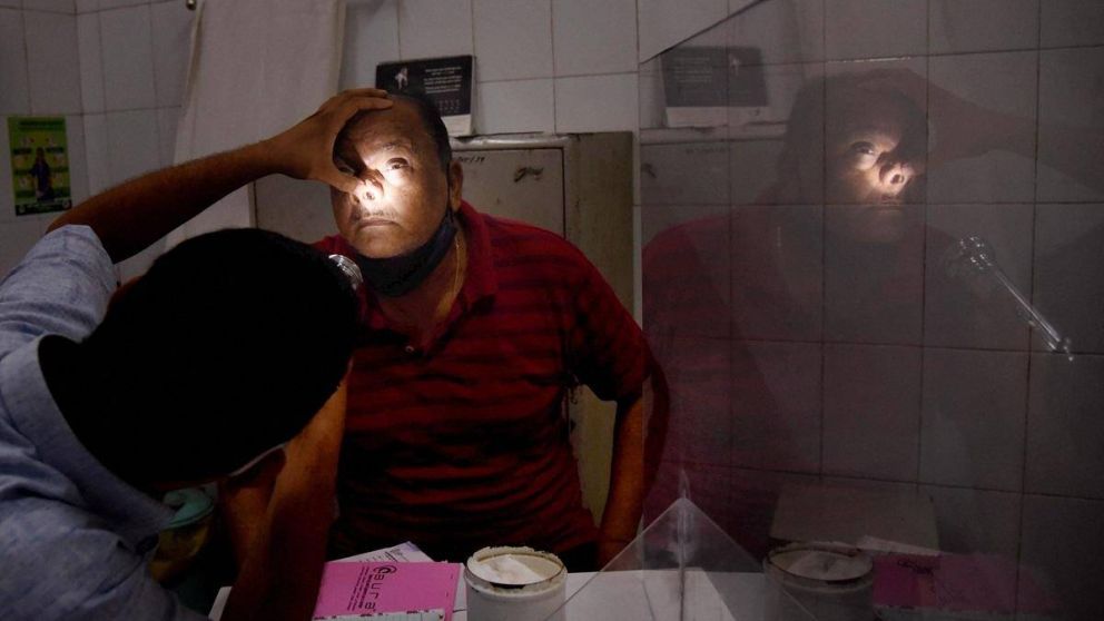 El "hongo negro" es una enfermedad que puede venir después del Covid-19