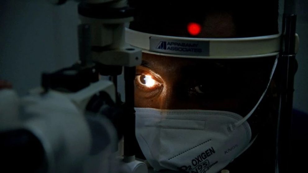 Los detalles del "hongo negro" relacionado al Covid