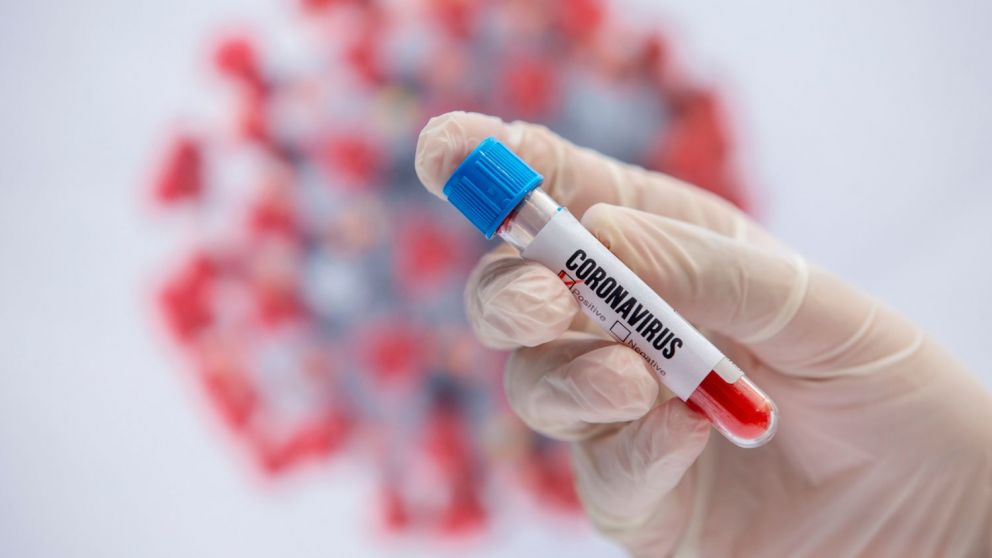 Casos de coronavirus hoy en Argentina