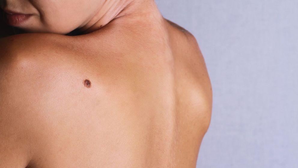El "Derm Assist" puede detectar hasta 288 afecciones distintas