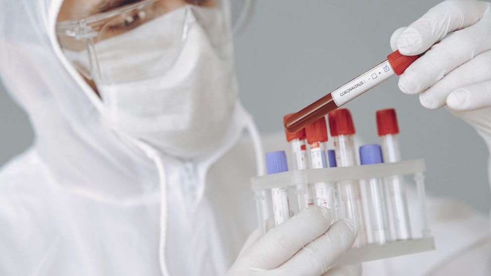 Reporte de casos de coronavirus hoy