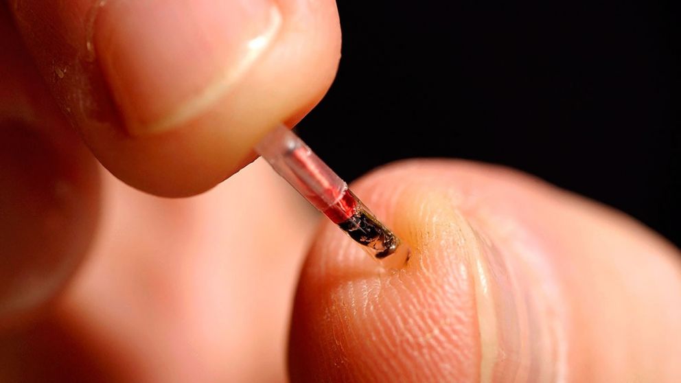 El pequeño dispositivo envía una señal al paciente para que realice un análisis de sangre rápido y poder confirmar el resultado positivo.