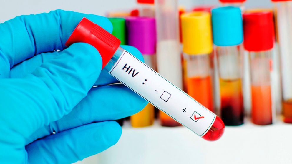 VIH: Una argentina logró controlar el virus
