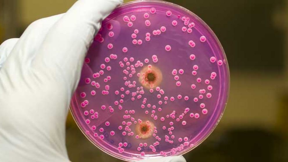 Uno de cada tres pacientes mueren dentro del mes de haber recibido el diagnóstico de una infección invasiva por Candida auris.