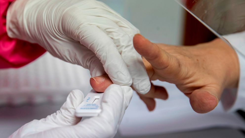 Fueron descubiertos en  descubiertos en la lengua,�manos y pies de los pacientes infectados