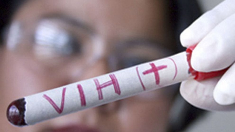 Dia Mundial del Sida: bajan los nuevos casos de infecci�n con VIH y suben los de s�filis