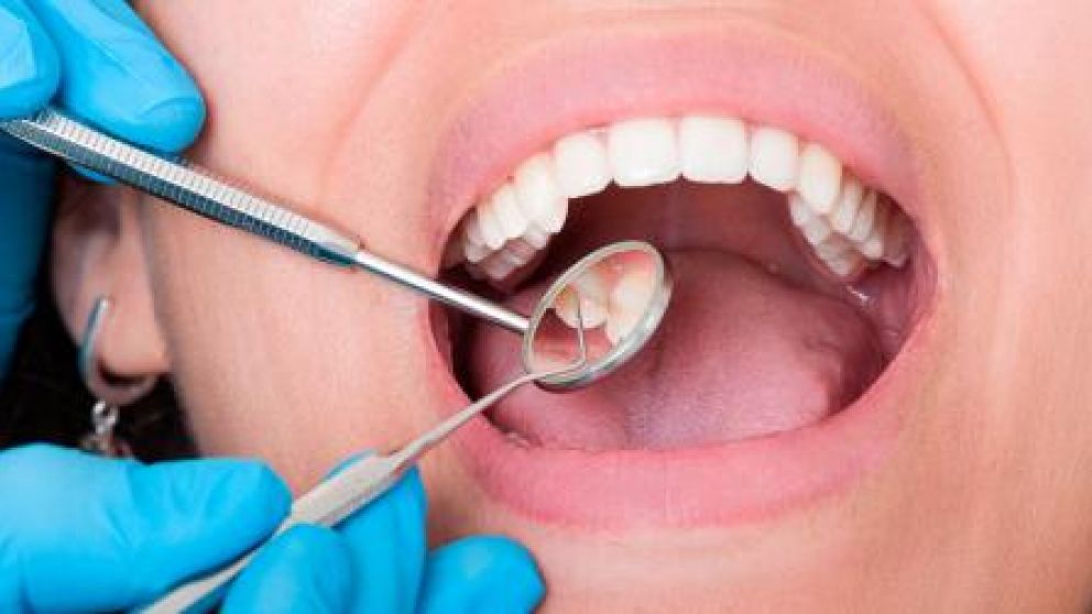 Ca�da de dientes: posible nueva secuela del Covid-19