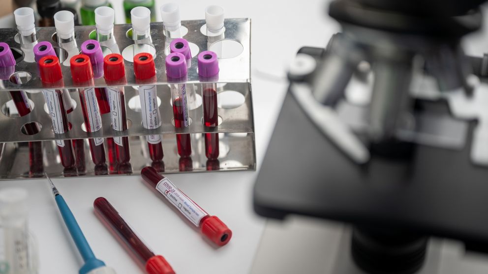 La quercetina podría ser una forma de dar pelea al coronavirus