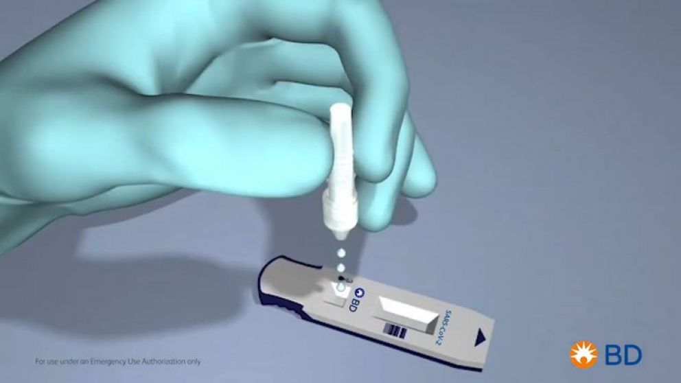 El test tiene un valor predictivo positivo (VPP) del 100%