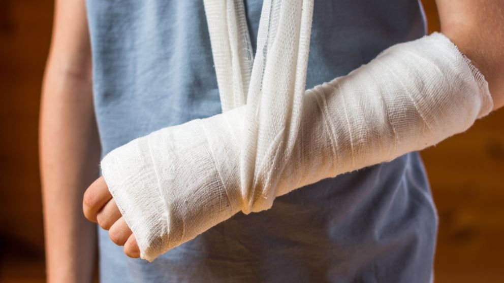 Especialistas alertan sobre el aumento de accidentes domésticos durante el aislamiento