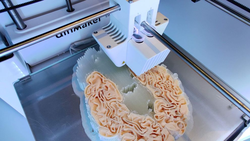 La impresión 3D también posibilita salvar vidas