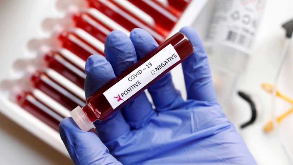 �Qu� tipo de sangre es m�s susceptible al coronavirus?