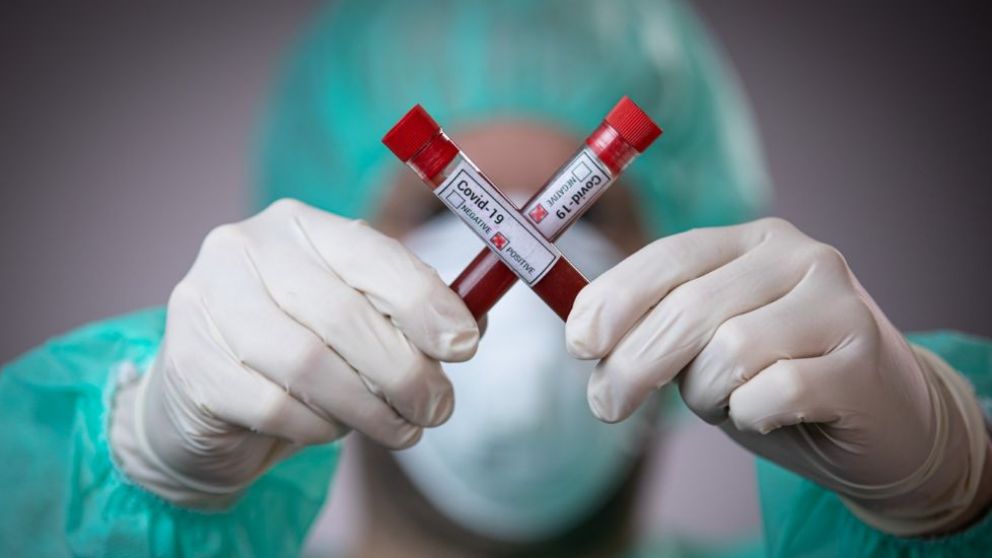 Alarmante revelación sobre pacientes asintomáticos con Covid-19