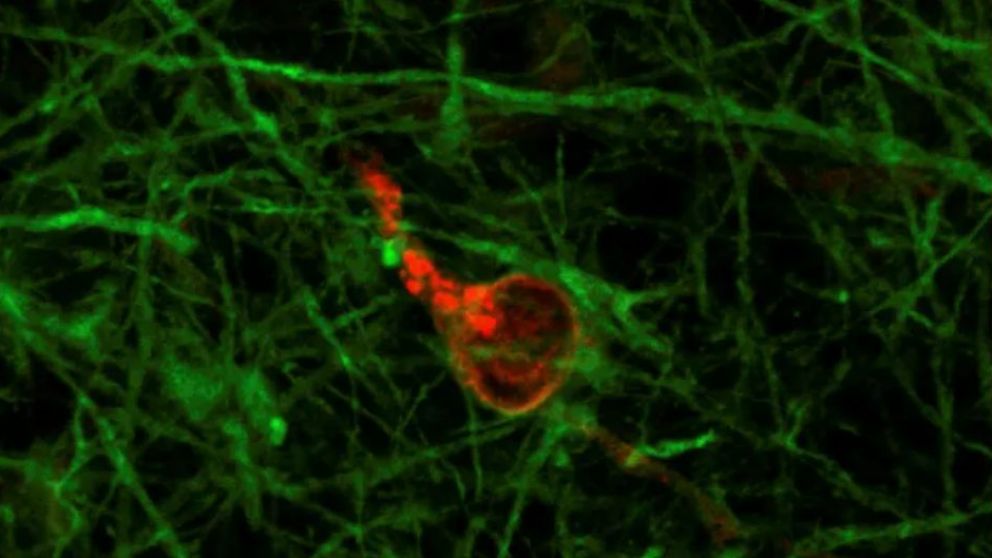 Imagen microscópica del "minicerebro" que muestra una neurona teñida de rojo para mostrar infección con coronavirus