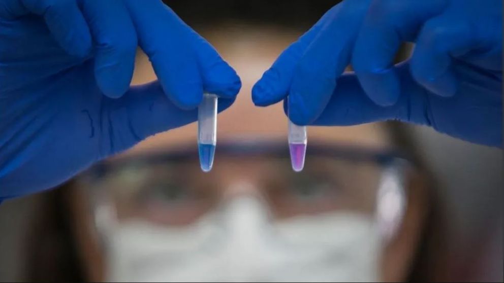 Los test r�pidos de diagn�stico permiten saber en una hora si una persona porta el virus o no