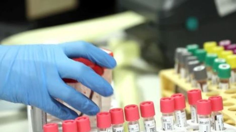 El Ministerio de Ciencia recibirá una partida adicional destinado al programa de fortalecimiento de proyectos de combate al covid-19