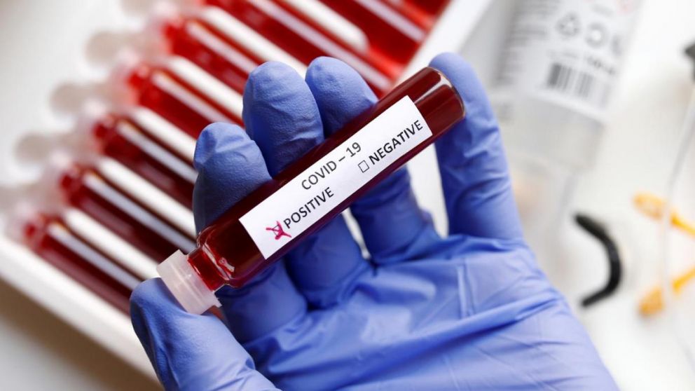 Cuánto cuesta hacerse el test de coronavirus en América latina