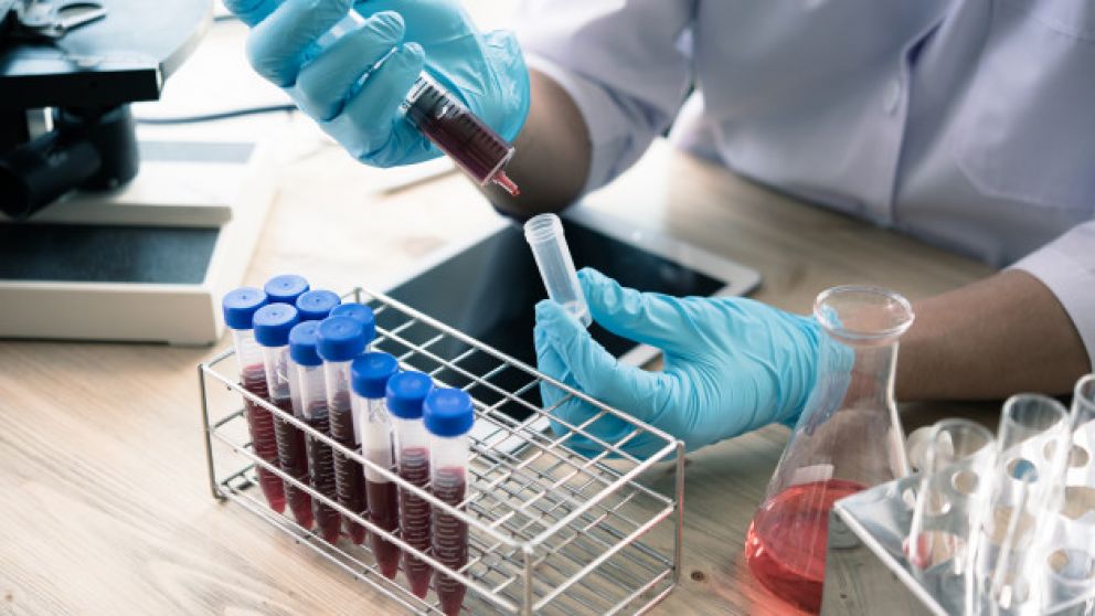 La página web desde donde se puede realizar el test o se puede descargar la aplicación es: https://www.argentina.gob.ar/coronavirus/app