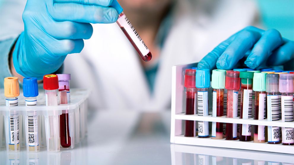 Los pacientes del tipo de sangre A contaban con riesgo mayor