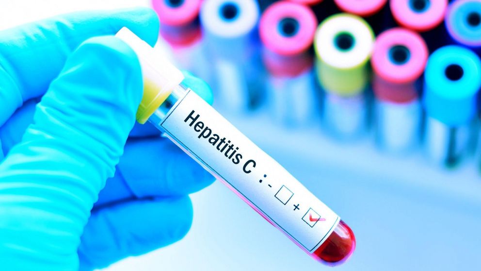 En el mundo, 325 millones de personas viven con hepatitis B o C