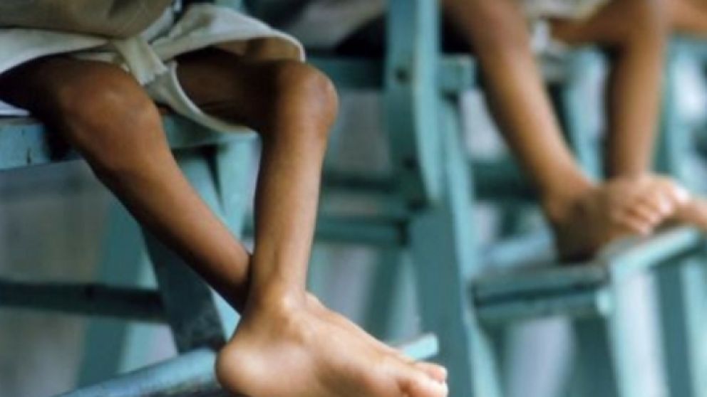 Unicef advierte sobre claros signos de desnutrición en los niños venezolanos