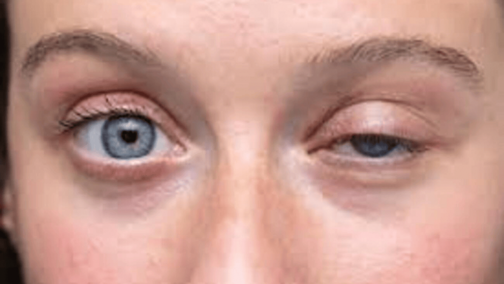 ¿Por qué palpita el ojo? El verdadero significado espiritual detrás de este fenómeno