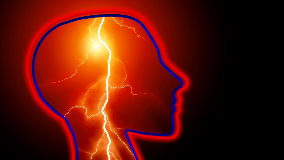 La epilepsia puede prevenirse en un 30% de los casos