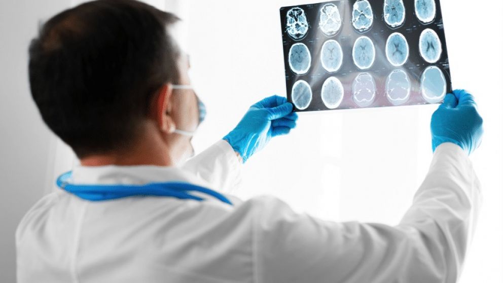 Alzheimer: Investigadores argentinos identifican mecanismos celulares tempranos