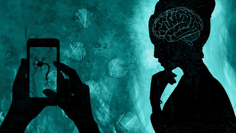 Solo 1 de cada 10 casos corresponde a Alzheimer