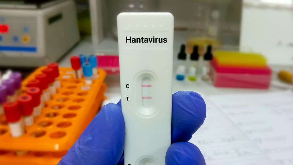 Un estudio del Instituto Malbr�n hall� que la carragenina, usada contra el Covid, podr�a reducir la carga viral del hantavirus